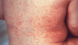 lekker he antivaxgekkies lekker he antivaxgekkies